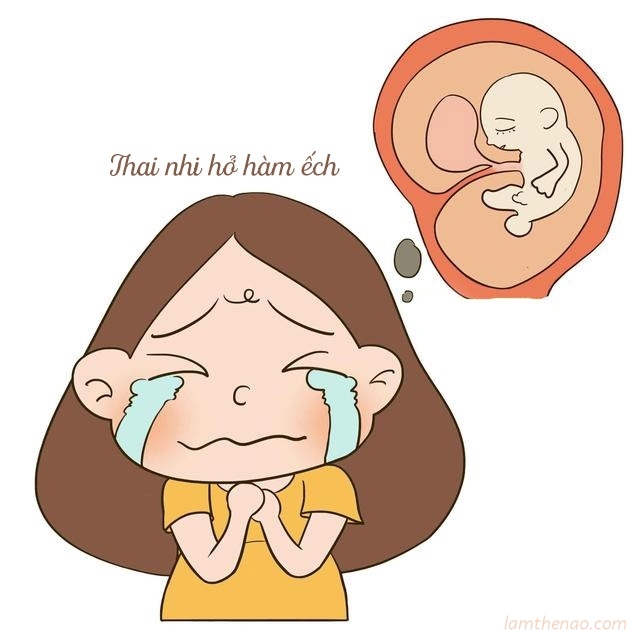 Những sai lầm của mẹ khiến bé sinh ra hở hàm ếch