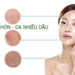 Kem chống nắng cho da dầu