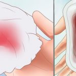 Đừng bao giờ chủ quan khi thấy ra máu đen sau kì kinh nguyệt - Ảnh 1.