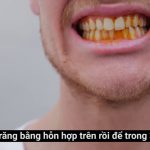 maxresdefault