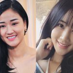 Chưa đầy 1 tháng mà khuôn mặt sau khi thẩm mỹ của Maya khiến nhiều người không nhận ra - Ảnh 7.
