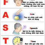 Đột quỵ và chỉ còn 20% cơ hội sống: Thảm cảnh kinh hoàng mà cô gái 17 tuổi gặp phải sau khi uống thuốc tránh thai - Ảnh 3.