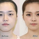 Câu chuyện đằng sau cuộc chạy đua nhan sắc ở Hàn Quốc: Khi chuẩn mực phương Tây và ngành công nghiệp dao kéo lên ngôi - Ảnh 6.