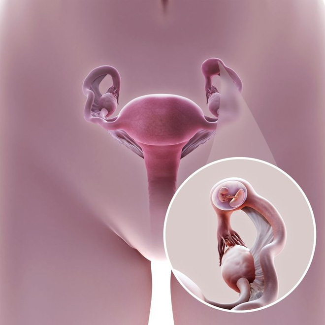 Nguyên nhân que thử thai cho kết quả sai, chị em nào đang ngóng 2 vạch đều cần biết để không hụt hẫng - Ảnh 5.