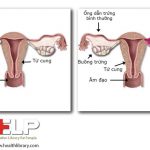 Căn bệnh nhiễm trùng không có triệu chứng rõ ràng này hoàn toàn có thể khiến bạn bị vô sinh - Ảnh 3.