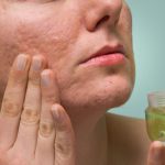 Thực hư chuyện Vitamin E giúp làm mờ vết sẹo - Ảnh 3.